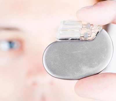 Implantable cardioverter defibrillators work a bit differently from a pacemaker, as they are used to correct abnormal heart rhythm with an electrical current